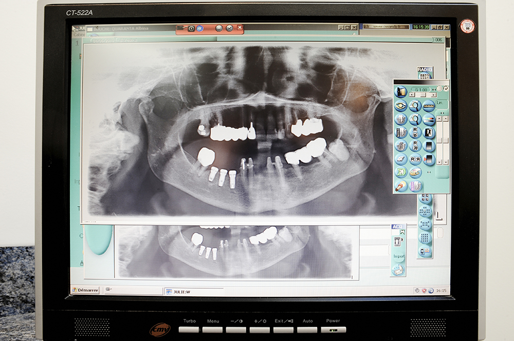 Radiologie cabinet dentaire Marseille